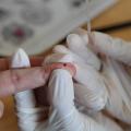 enfermeiro fura dedo de paciente em teste #paratodosverem