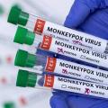 Mãos com luvas seguram tubos de ensaio com a inscrição monkeypox virus. #paratodosverem