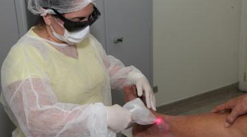 Mulher paramentada com avental, touca, luvas e óculos de proteção aplica laser na perna de um indivíduo. #Paratodosverem
