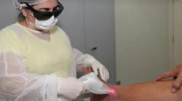 enfermeira usa laser em curativo #paratodosverem 