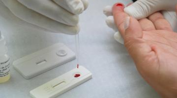 Teste de sífilis será oferecido na Unidade de Cuidado do Porto