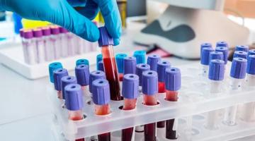 mão mexe em tubos de sangue extraídos para exame. #paratodosverem
