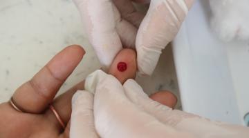 dedo passa por exame #paratodosverem 