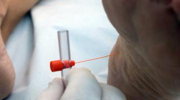 profissional espeta pé para exame #paratodosverem 