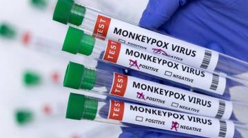 Mãos com luvas seguram tubos de ensaio com a inscrição monkeypox virus. #paratodosverem