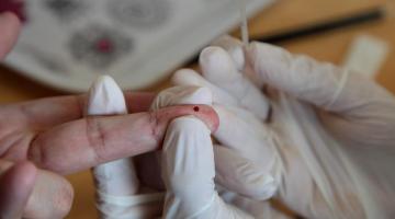 Julho amarelo: Santos alerta para as hepatites virais e intensificará testagens