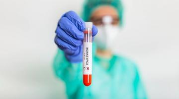 enfermeira segura tubo de ensaio com sangue #paratodosverem