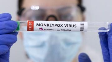 Santos registra 17 casos confirmados de varíola dos macacos