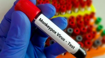 Santos tem nova confirmação e registra 24 casos de varíola dos macacos