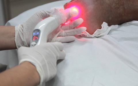 Imagem mostra aplicação de laser em pé de paciente com lesão. #pracegover