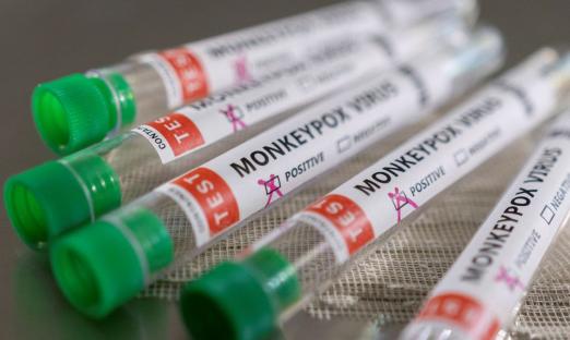 tubos de ensaio com adesivo onde se lê: monkeypox