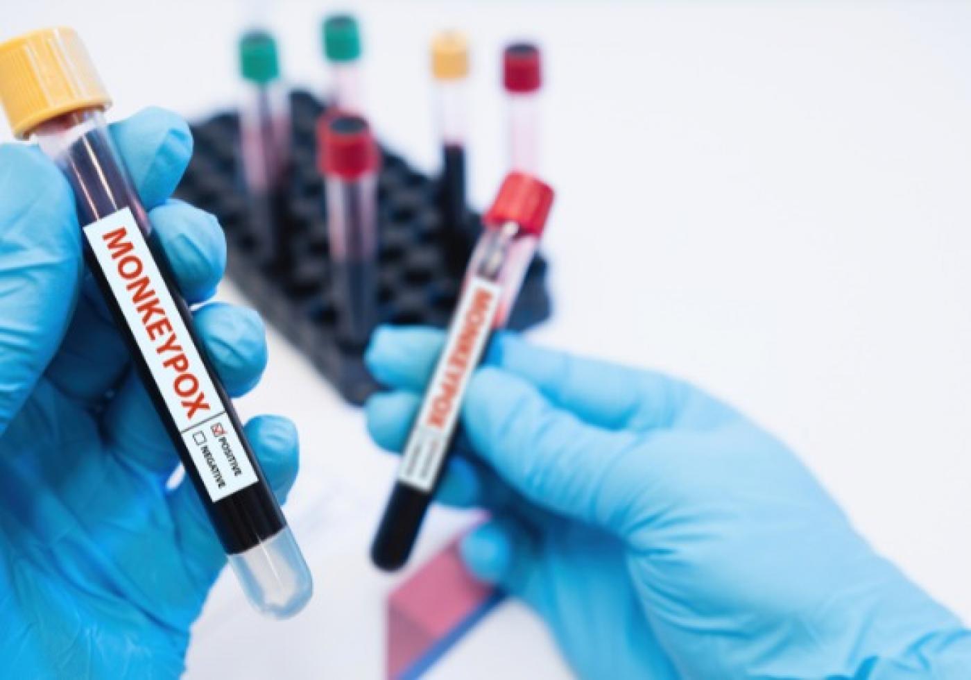 mãos seguram dois tubos de ensaio com amostras de sangue