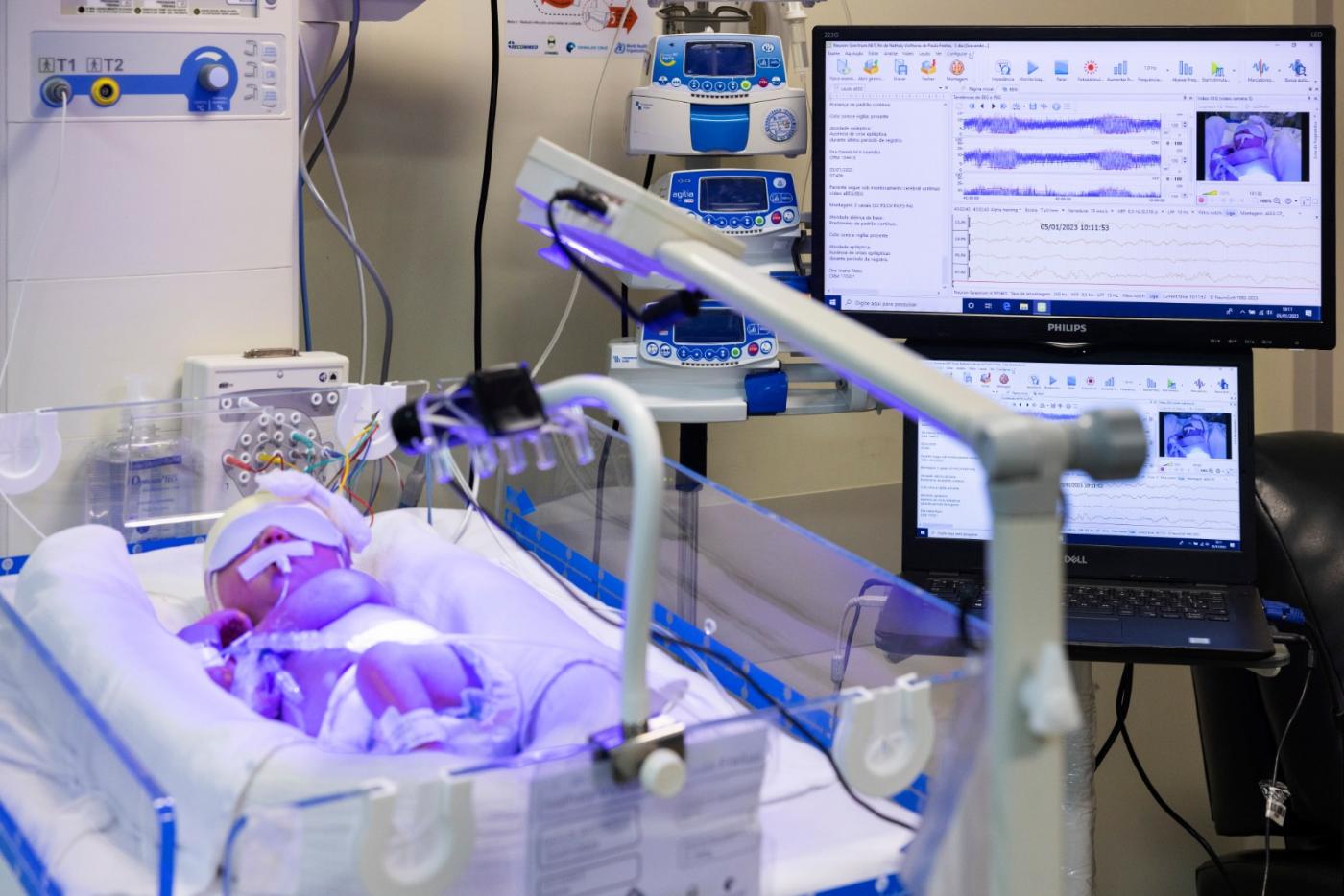 bebê sendo monitorado #paratodosverem 