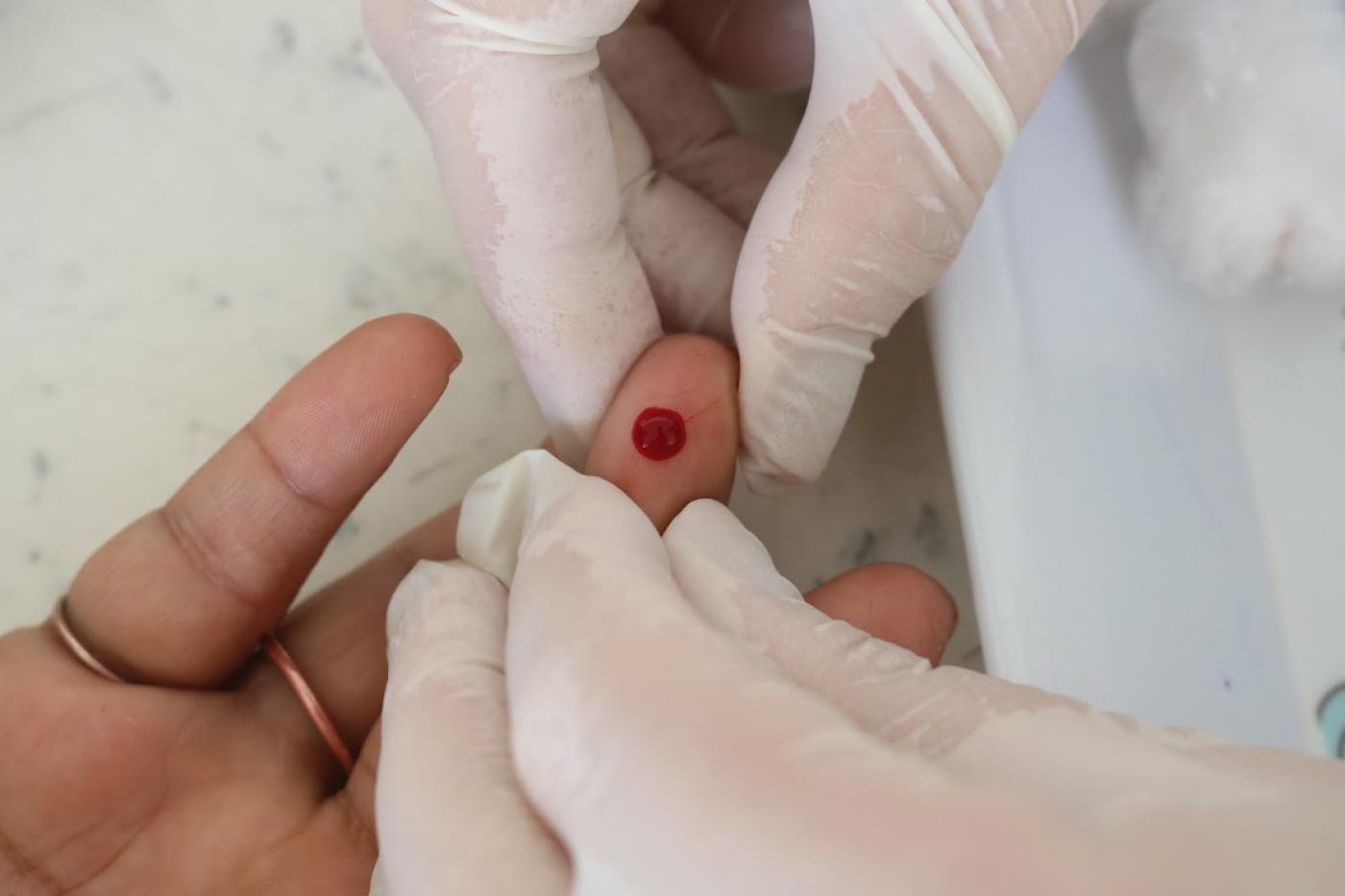 dedo passa por exame #paratodosverem 