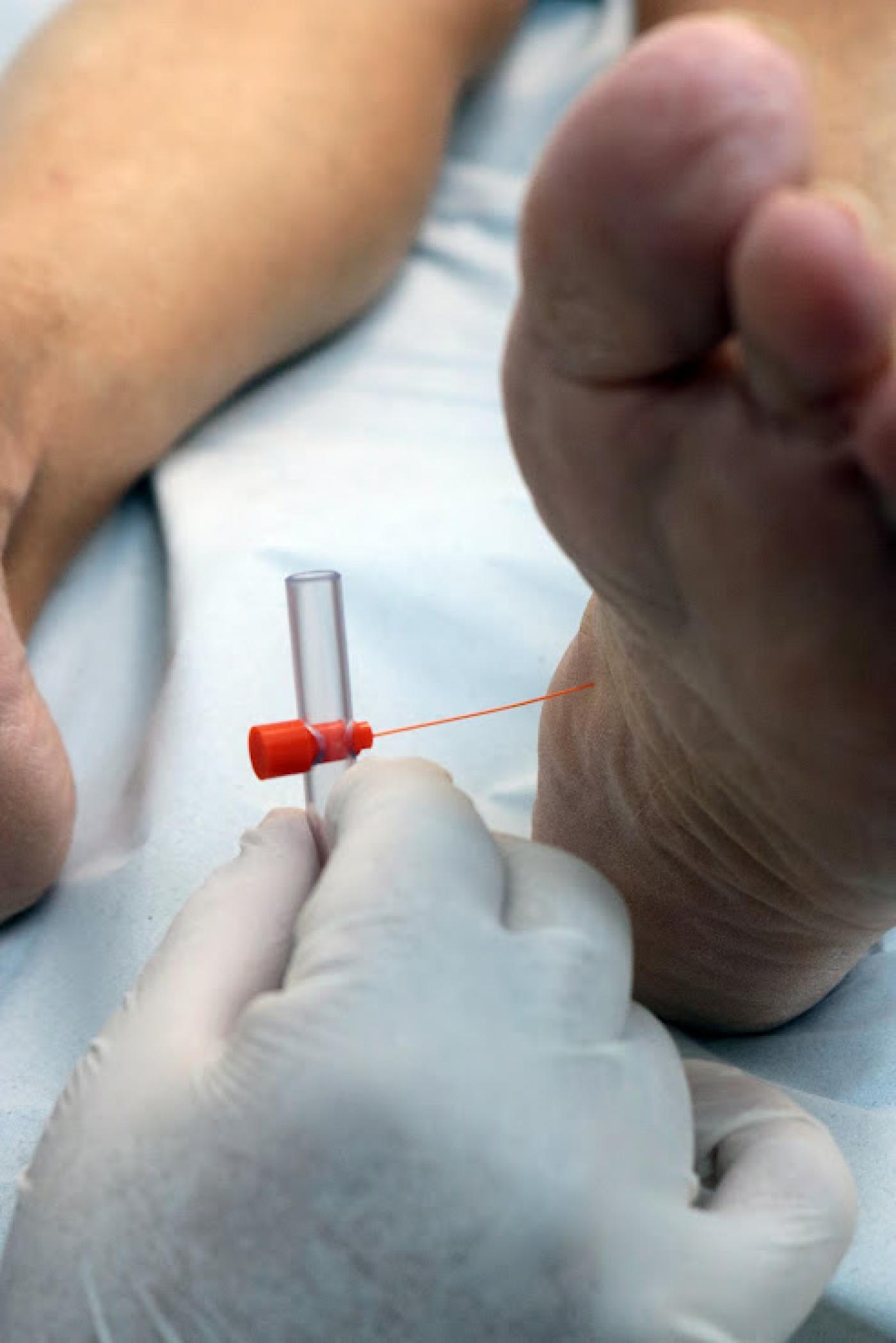 profissional espeta pé para exame #paratodosverem 