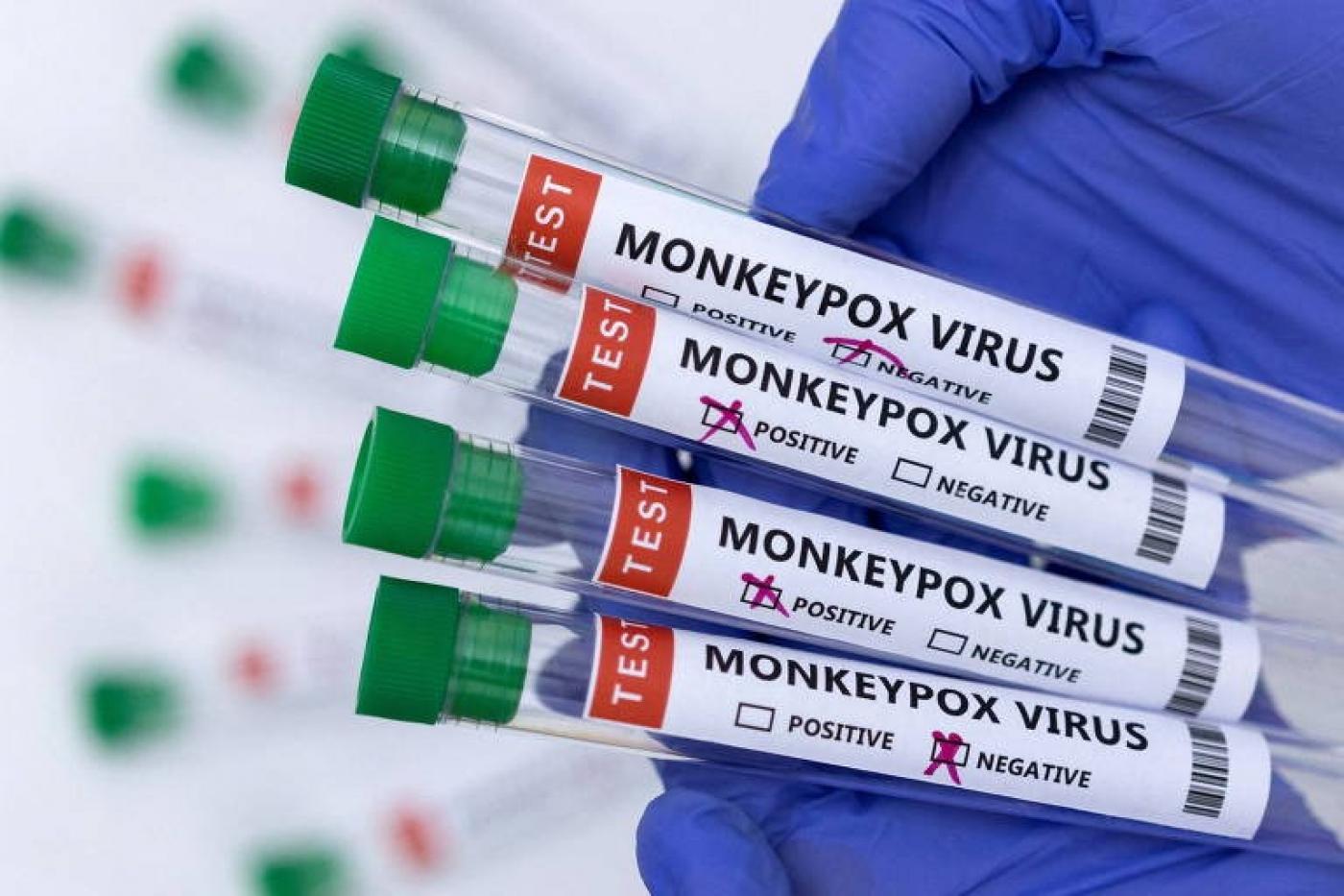 Mãos com luvas seguram tubos de ensaio com a inscrição monkeypox virus. #paratodosverem