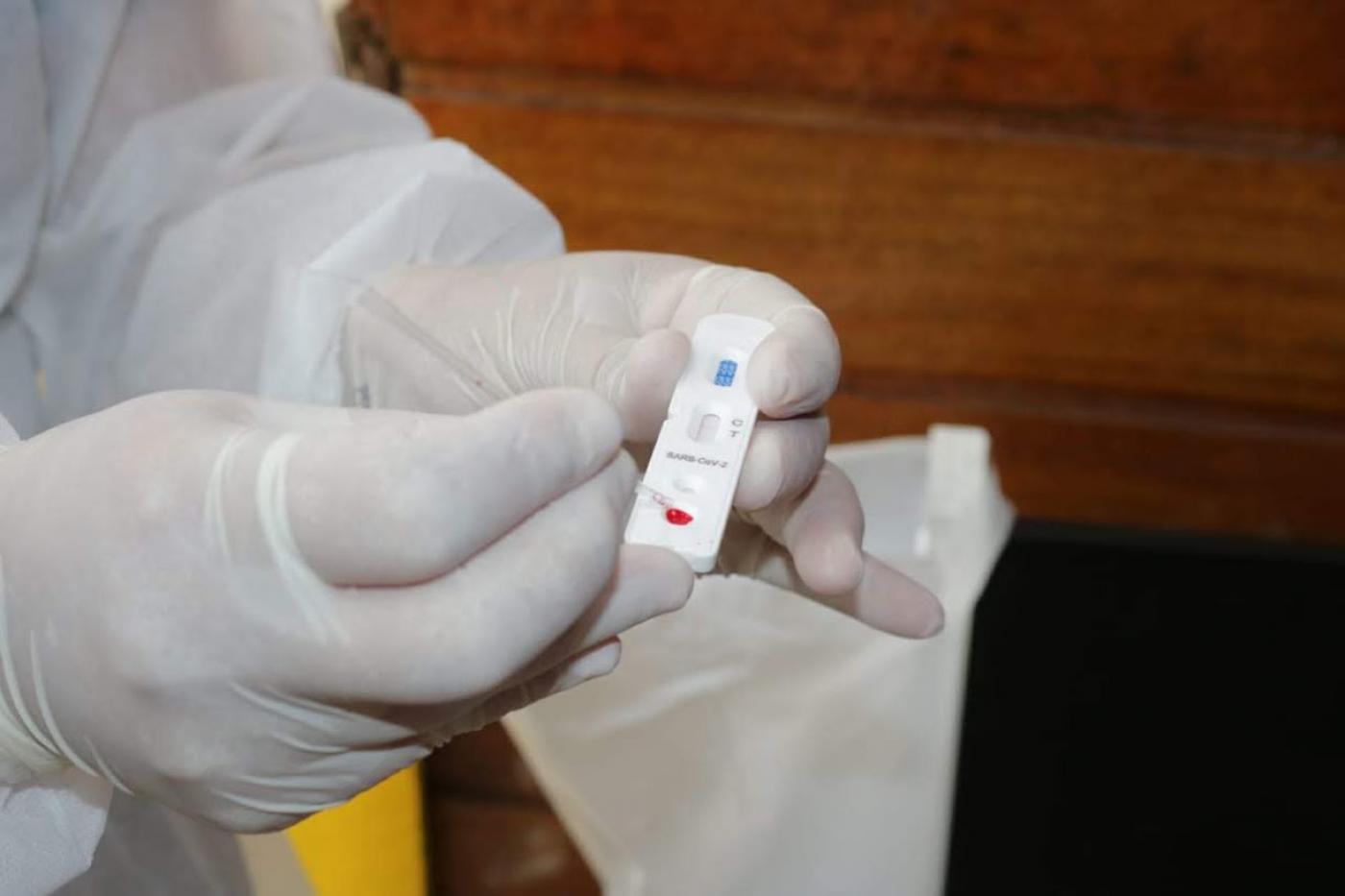 Teste rápido para detecção de covid. Mãos segura pequeno bastão onde é depositada uma cota de sangue. #Paratodosverem