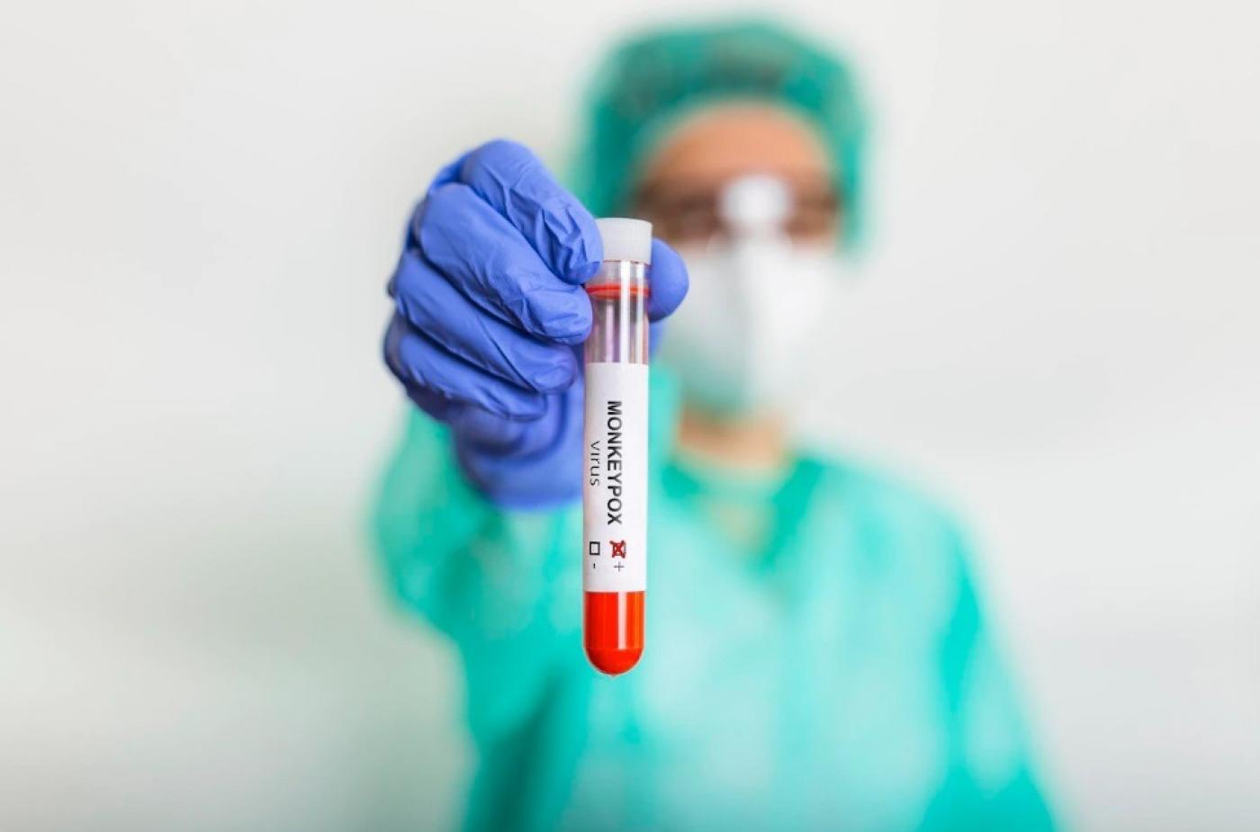 enfermeira segura tubo de ensaio com sangue #paratodosverem