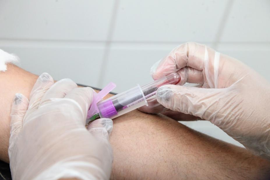Imagem em close mostra mãos fazendo exame de sangue em braço. #Paratodosverem